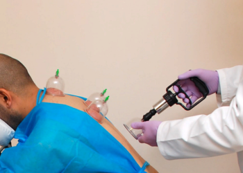 Хиджама: достоинства, правила и ее особенности