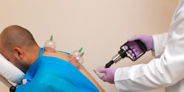 Хиджама: достоинства, правила и ее особенности