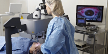 Правила лазерной коррекции зрения и советы