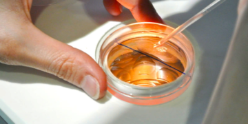 Донація яйцеклітин: поняття, технологія та основні правила