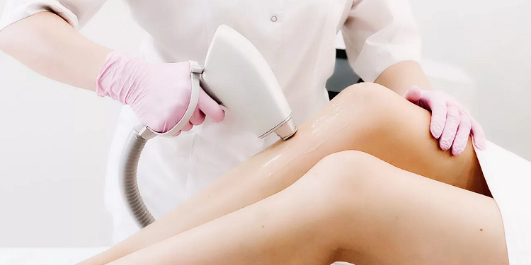 Как открыть студию лазерной эпиляции по франшизе