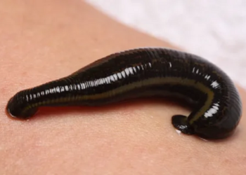 Медицинские пиявки: особенности применения и их достоинства