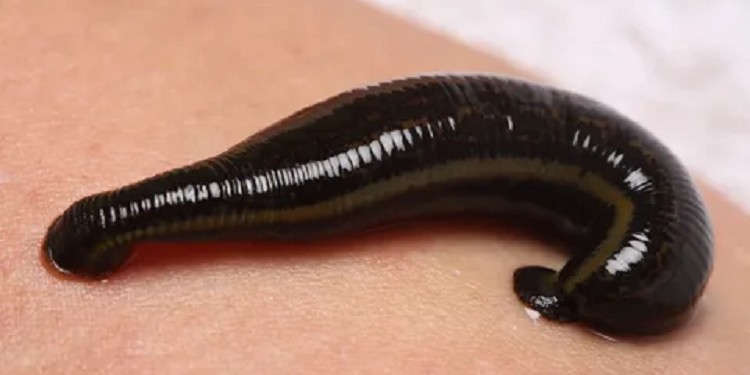 Медицинские пиявки: особенности применения и их достоинства