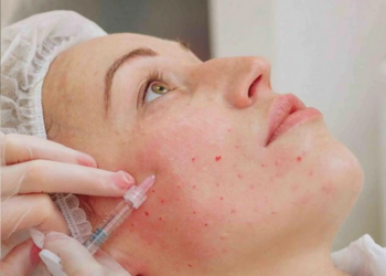 Биоревитализация: требования, понятие и суть