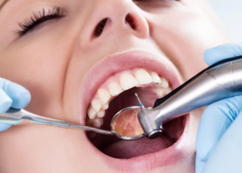 Чистка и лечение кариеса в стоматологии: достоинства и правила