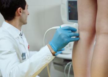 Лазерне лікування варикозу: як це працює та чи безпечно