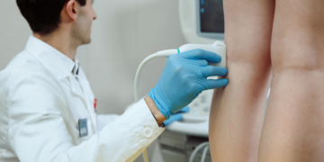 Лазерне лікування варикозу: як це працює та чи безпечно