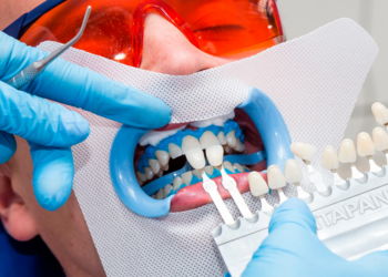 Отбеливание зубов в стоматологии: достоинства и правила