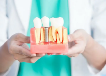 От древних попыток к современной точности: история имплантации зубов