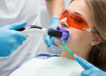 Лазерная чистка зубов: достоинства и правила