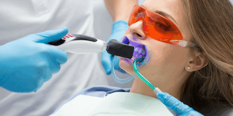 Лазерная чистка зубов: достоинства и правила
