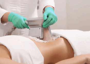 Криолиполиз: безопасное и эффективное решение для коррекции фигуры