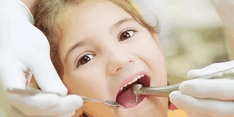 Лечение пульпита у детей: забота о детских зубах в клиниках