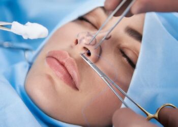 Все, что нужно знать о риносептопластике и ее главных преимуществах