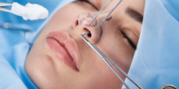 Все, что нужно знать о риносептопластике и ее главных преимуществах