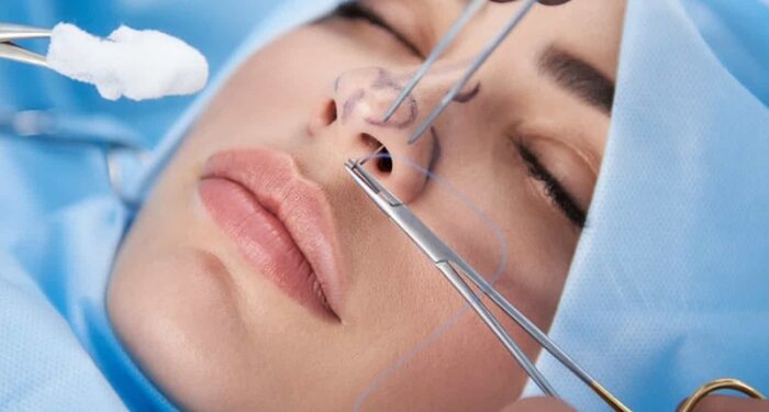 Все, что нужно знать о риносептопластике и ее главных преимуществах