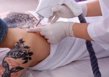 Преимущества лазерного удаления тату и правила безопасного проведения процедуры