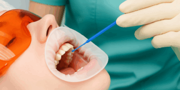 Эффективные методы восстановления зубной эмали и правила ухода за ней