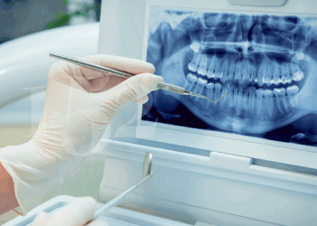 Обзор видов, требований и способов выбора стоматологических рентгенов для безопасной диагностики