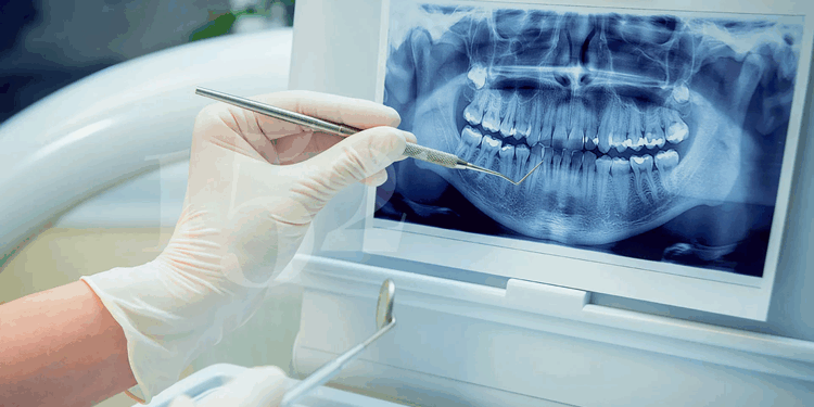 Обзор видов, требований и способов выбора стоматологических рентгенов для безопасной диагностики